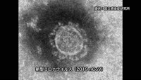 新型コロナウイルス 影響と予防